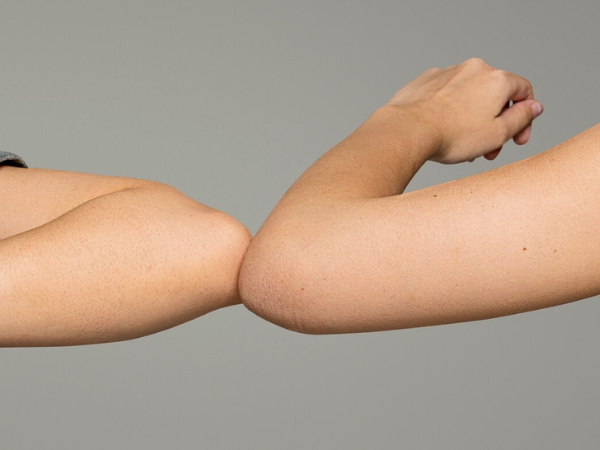 آیا نتایج لیپوساکشن بازو دائمی است؟